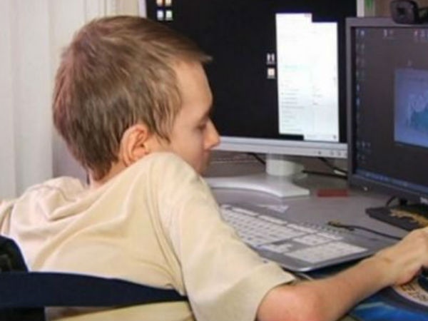 ആദ്യ തലമാറ്റിവയ്ക്കല്‍ ശസ്ത്രക്രിയയ്ക്ക് സന്നദ്ധമാണെന്ന് യുവാവ്...!