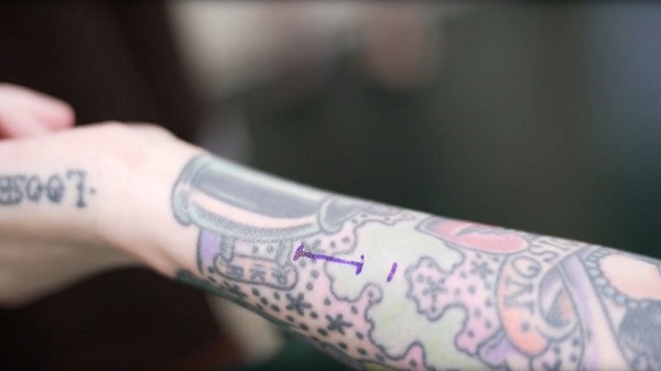 സ്വന്തം ശരീരം ബയോഹാക്ക് ചെയ്ത് യുവതി; കൈ ടെസ്ല കാറിന്റെ കീ ആകുമോ?